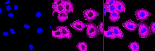 CAP1 Antibody in Immunocytochemistry (ICC/IF)