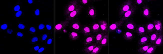 CLPTM1 Antibody in Immunocytochemistry (ICC/IF)