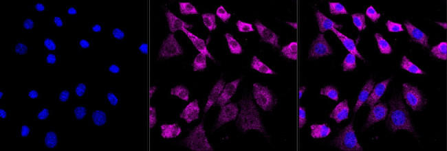 BAG1 Antibody in Immunocytochemistry (ICC/IF)