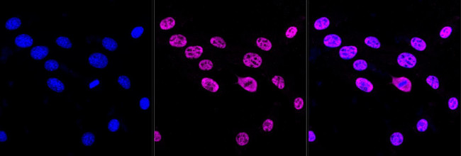 AKAP8 Antibody in Immunocytochemistry (ICC/IF)