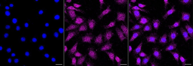 BIN1 Antibody in Immunocytochemistry (ICC/IF)