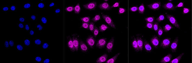 C3orf38 Antibody in Immunocytochemistry (ICC/IF)