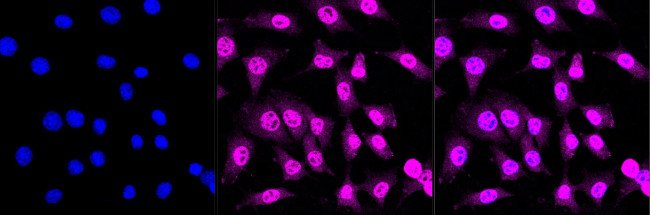APC6 Antibody in Immunocytochemistry (ICC/IF)