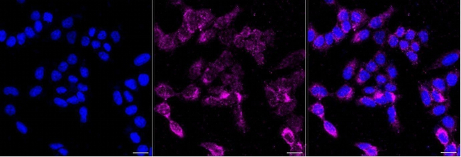 ALAS1 Antibody in Immunocytochemistry (ICC/IF)