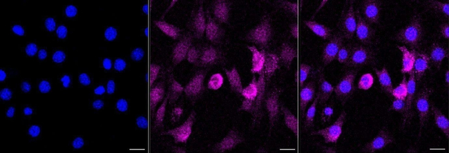 CD36 Antibody in Immunocytochemistry (ICC/IF)