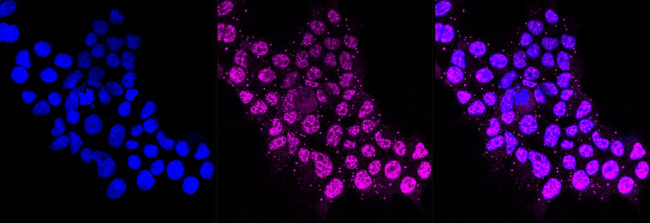 CDC25C Antibody in Immunocytochemistry (ICC/IF)