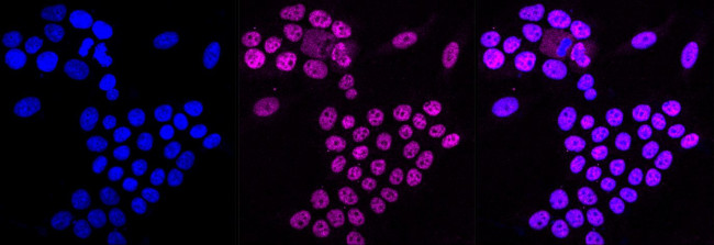APC6 Antibody in Immunocytochemistry (ICC/IF)