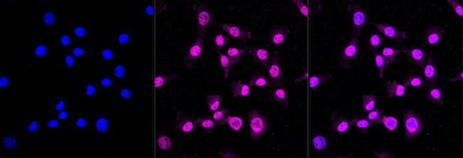 Cdc23 Antibody in Immunocytochemistry (ICC/IF)