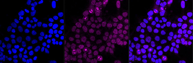 Carbonic Anhydrase II Antibody in Immunocytochemistry (ICC/IF)