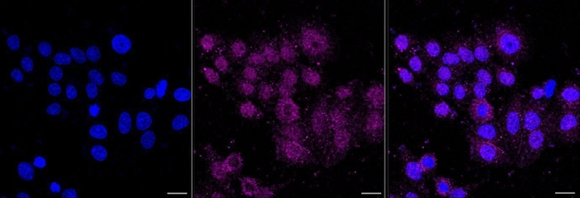 CD97 Antibody in Immunocytochemistry (ICC/IF)