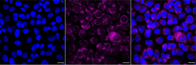 EOGT Antibody in Immunocytochemistry (ICC/IF)