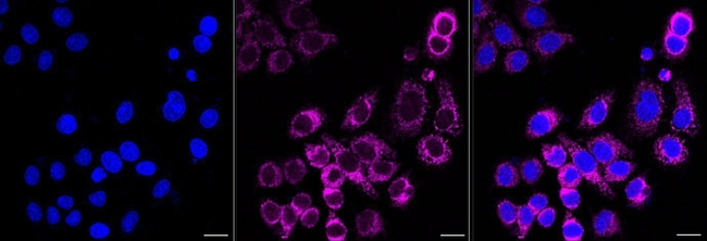 CSDE1 Antibody in Immunocytochemistry (ICC/IF)