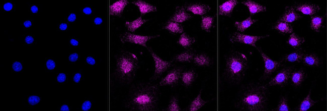 CBX2 Antibody in Immunocytochemistry (ICC/IF)