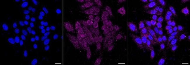 ABCE1 Antibody in Immunocytochemistry (ICC/IF)