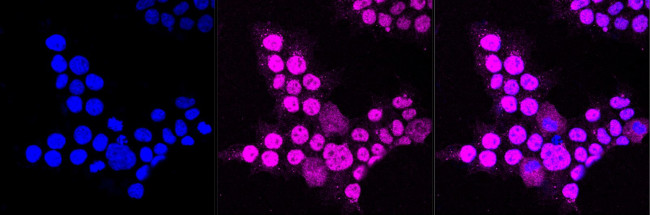 ACBD3 Antibody in Immunocytochemistry (ICC/IF)