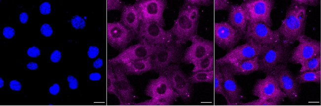 GEF-H1 Antibody in Immunocytochemistry (ICC/IF)