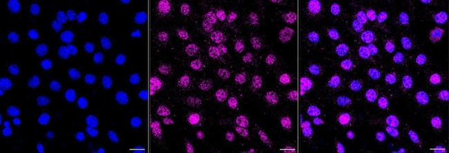 CBF beta Antibody in Immunocytochemistry (ICC/IF)