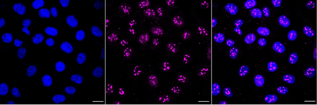 COMT Antibody in Immunocytochemistry (ICC/IF)