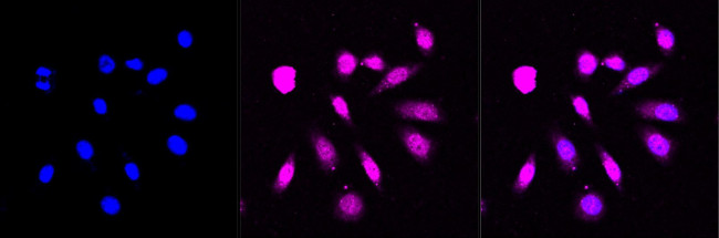 ACADVL Antibody in Immunocytochemistry (ICC/IF)