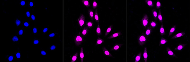 Calpain S1 Antibody in Immunocytochemistry (ICC/IF)