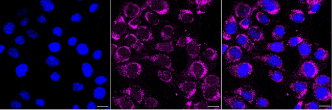 DLD Antibody in Immunocytochemistry (ICC/IF)