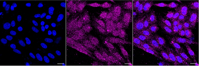 GRP78 Antibody in Immunocytochemistry (ICC/IF)