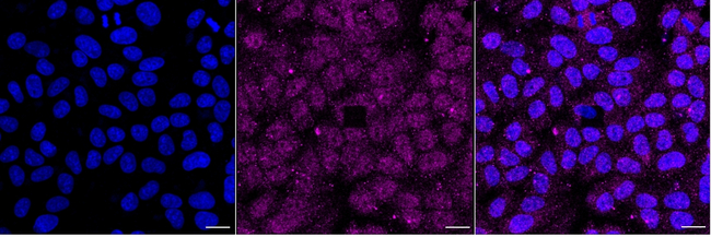 HSC70 Antibody in Immunocytochemistry (ICC/IF)