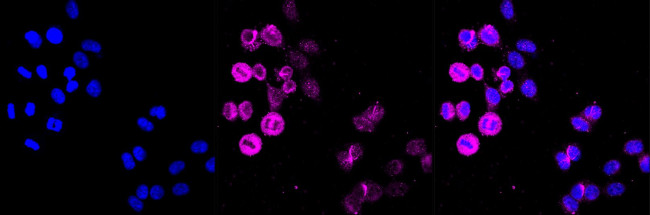 METAP2 Antibody in Immunocytochemistry (ICC/IF)