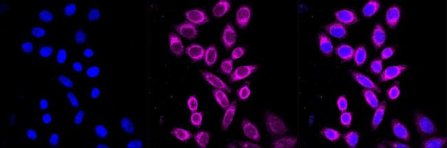 MLKL Antibody in Immunocytochemistry (ICC/IF)