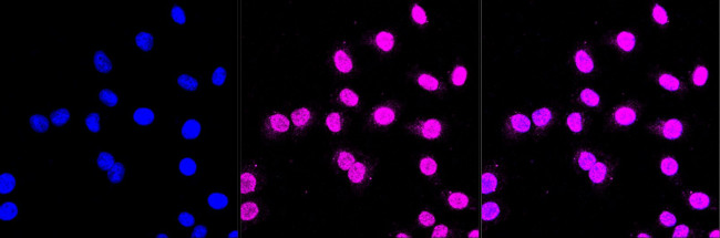 MLKL Antibody in Immunocytochemistry (ICC/IF)