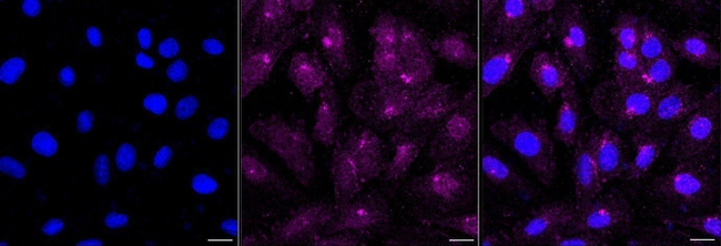 MMP14 Antibody in Immunocytochemistry (ICC/IF)