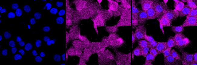 PEPD Antibody in Immunocytochemistry (ICC/IF)