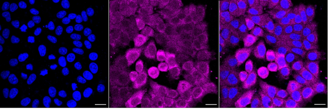 PGK1 Antibody in Immunocytochemistry (ICC/IF)