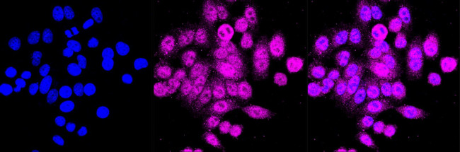 PLAA Antibody in Immunocytochemistry (ICC/IF)