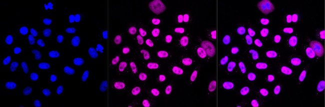 PPM1G Antibody in Immunocytochemistry (ICC/IF)