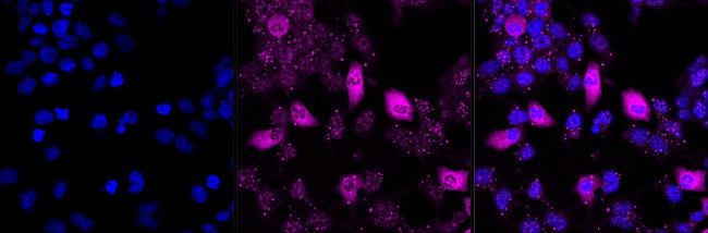Phospho-c-Raf (Ser621) Antibody in Immunocytochemistry (ICC/IF)
