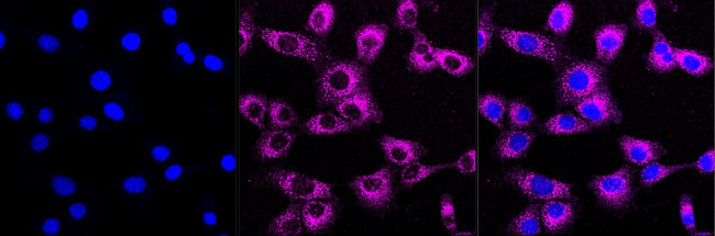 SEC24D Antibody in Immunocytochemistry (ICC/IF)
