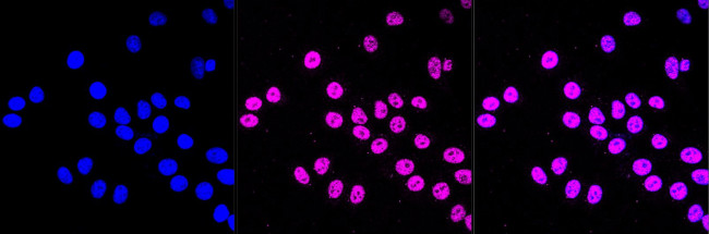HSPA9 Antibody in Immunocytochemistry (ICC/IF)