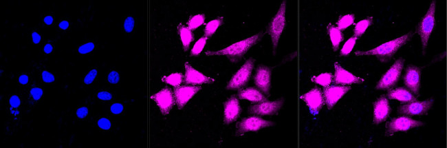 Annexin A10 Antibody in Immunocytochemistry (ICC/IF)