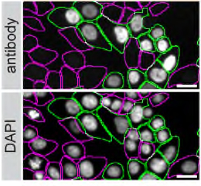 ARID1A Antibody in Immunocytochemistry (ICC/IF)