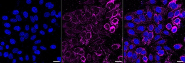 ATP Synthase beta Antibody in Immunocytochemistry (ICC/IF)