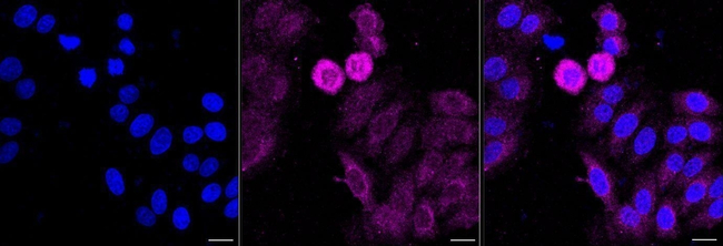 Clathrin Heavy Chain Antibody in Immunocytochemistry (ICC/IF)