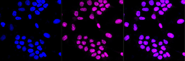 DEK Antibody in Immunocytochemistry (ICC/IF)