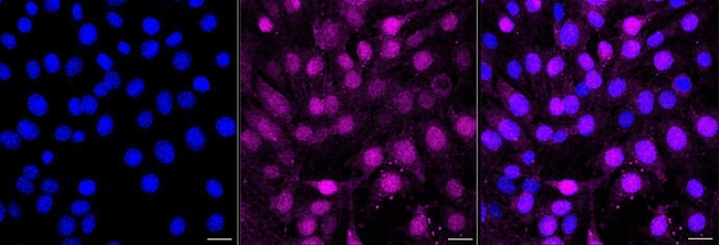 Phospho-CDK2 (Tyr15) Antibody in Immunocytochemistry (ICC/IF)