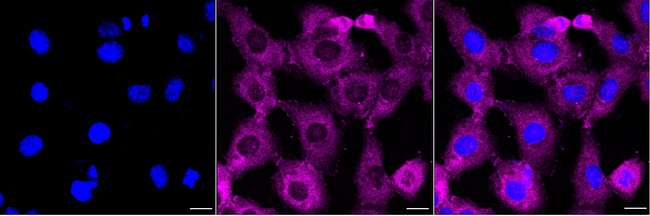 eIF4A1 Antibody in Immunocytochemistry (ICC/IF)