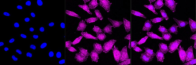 Phospho-beta Arrestin 1 (Ser412) Antibody in Immunocytochemistry (ICC/IF)