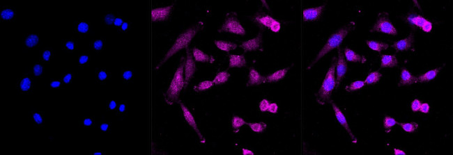 ARHGAP5 Antibody in Immunocytochemistry (ICC/IF)