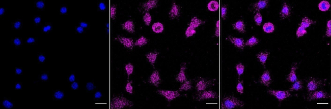 Phospho-p130Cas (Tyr410) Antibody in Immunocytochemistry (ICC/IF)