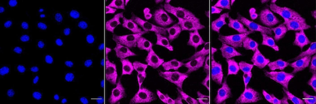 Phospho-eIF4B (Ser406) Antibody in Immunocytochemistry (ICC/IF)