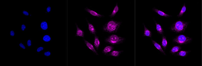 APLP2 Antibody in Immunocytochemistry (ICC/IF)